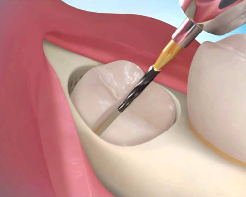 Cirugia oral 1
