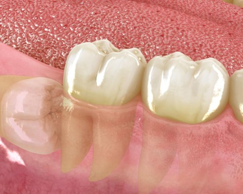 Cirugia oral 4