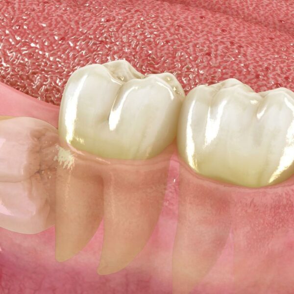 Cirugia oral 4